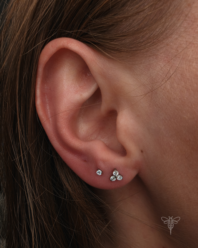 Upper Lobe vėrimas