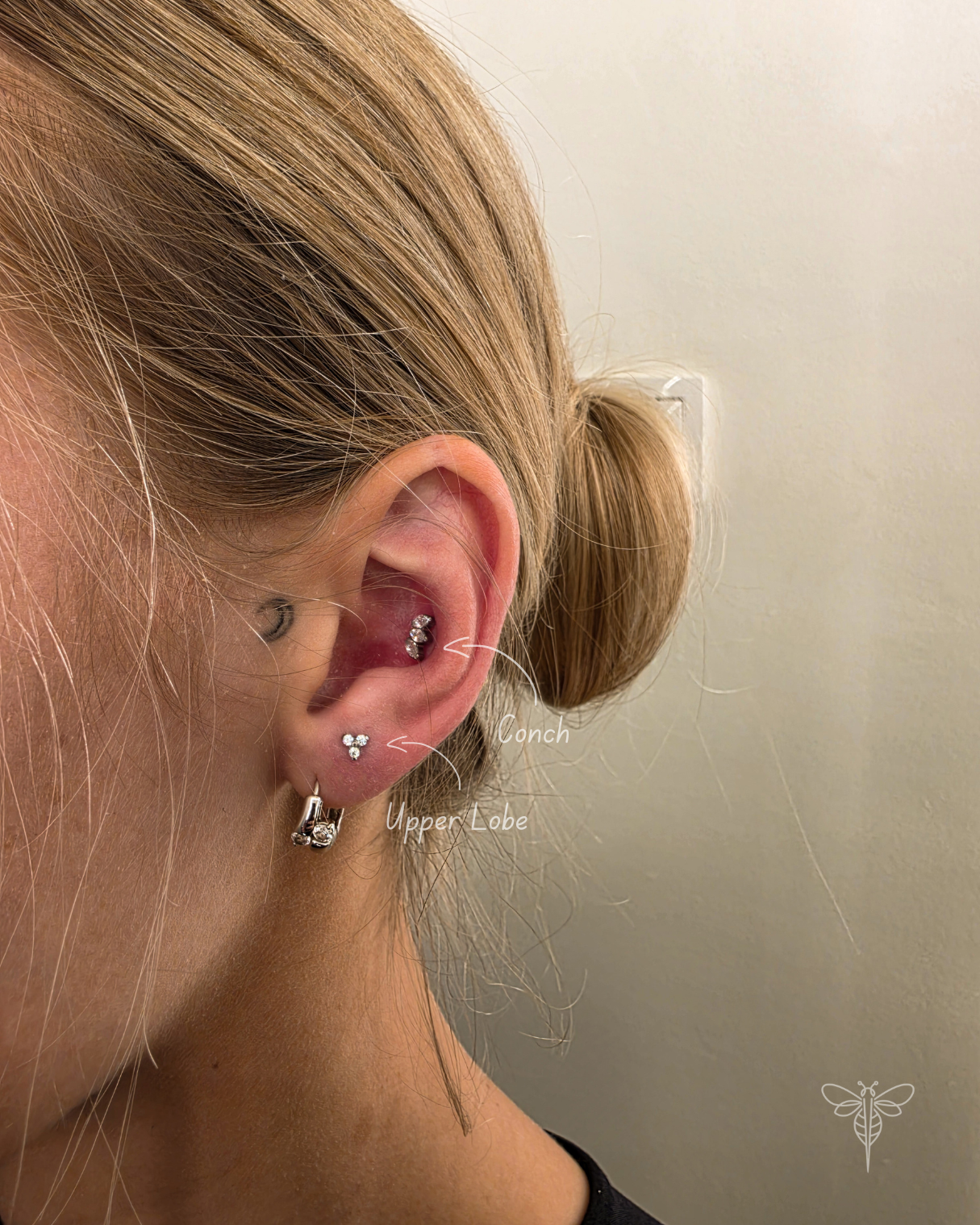 Conch ir upper lobe