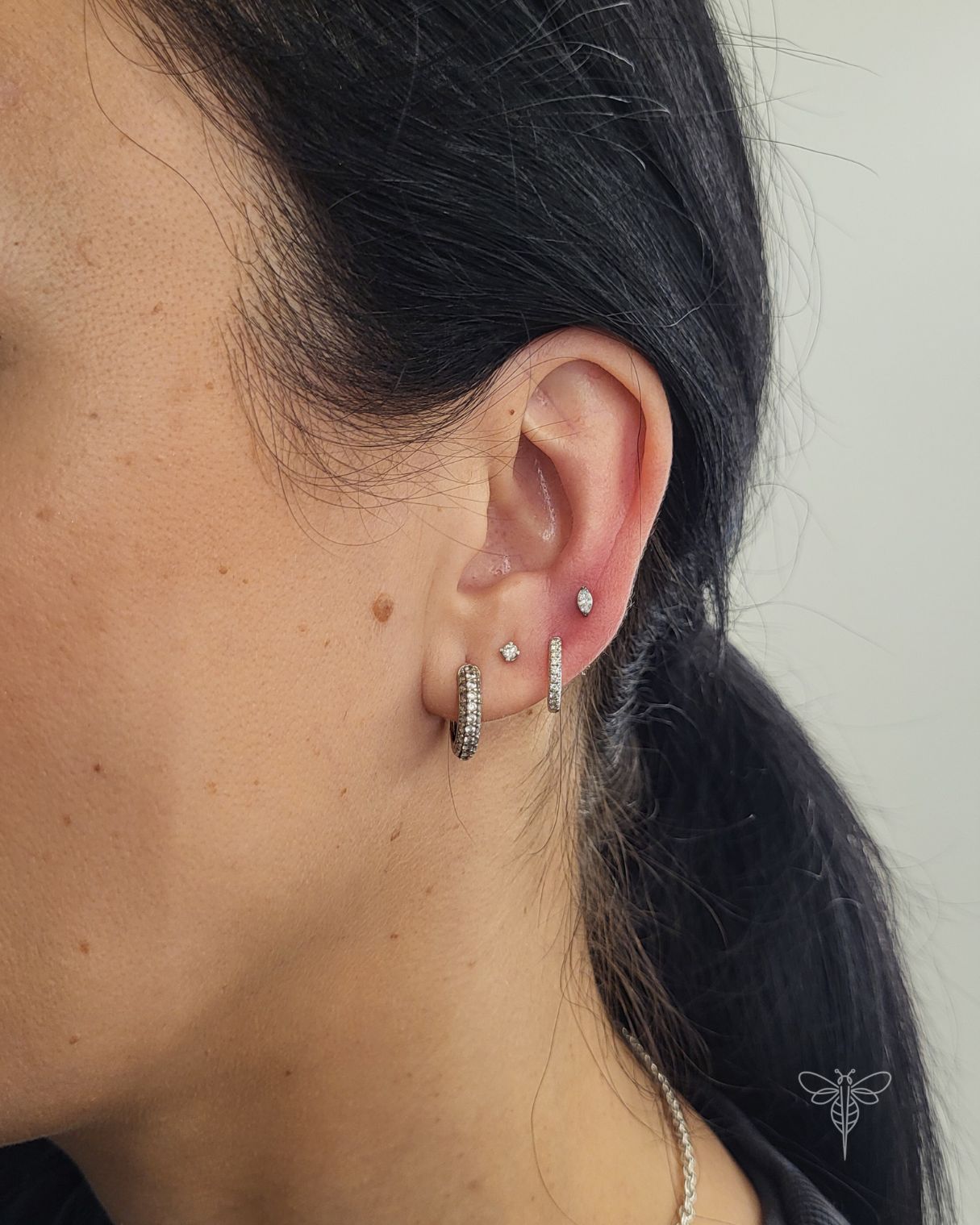 Upper Lobe